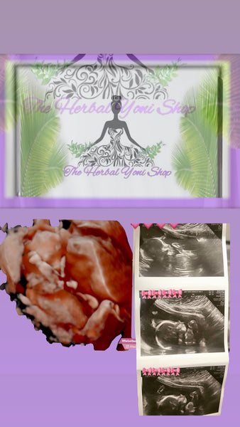 90 DAY FERTILITY PACKAGE